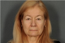 Eyelid Surgery Before Photo by Ellen Janetzke, MD; Bloomfield Hills, MI - Case 33143