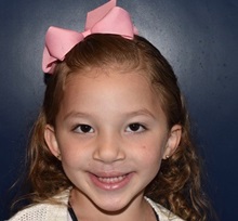 Cleft Lip and Palate Repair After Photo by Rachel Ruotolo, MD; Garden City, NY - Case 38033