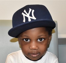 Cleft Lip and Palate Repair After Photo by Rachel Ruotolo, MD; Garden City, NY - Case 41957