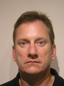 Eyelid Surgery After Photo by Joseph Fodero, MD; Florham Park, NJ - Case 9073