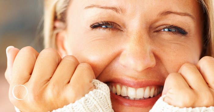 rise of the mid-facelift