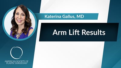Arm Lift Results