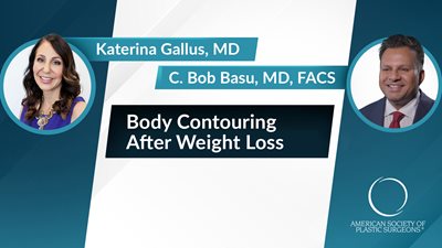 Body Contouring After Weight Loss