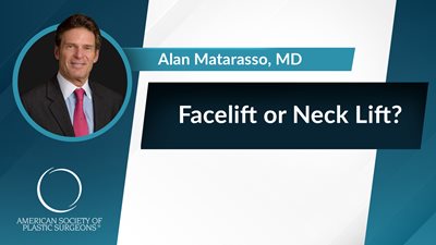 Facelift or Neck Lift?