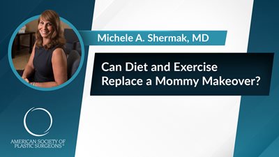Can Diet and Exercise Replace a Mommy Makeover?