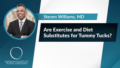 Are Exercise and Diet Substitutes for Tummy Tucks?
