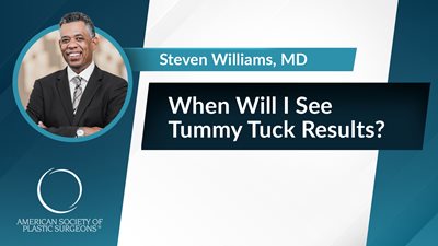 When Will I See Tummy Tuck Results?